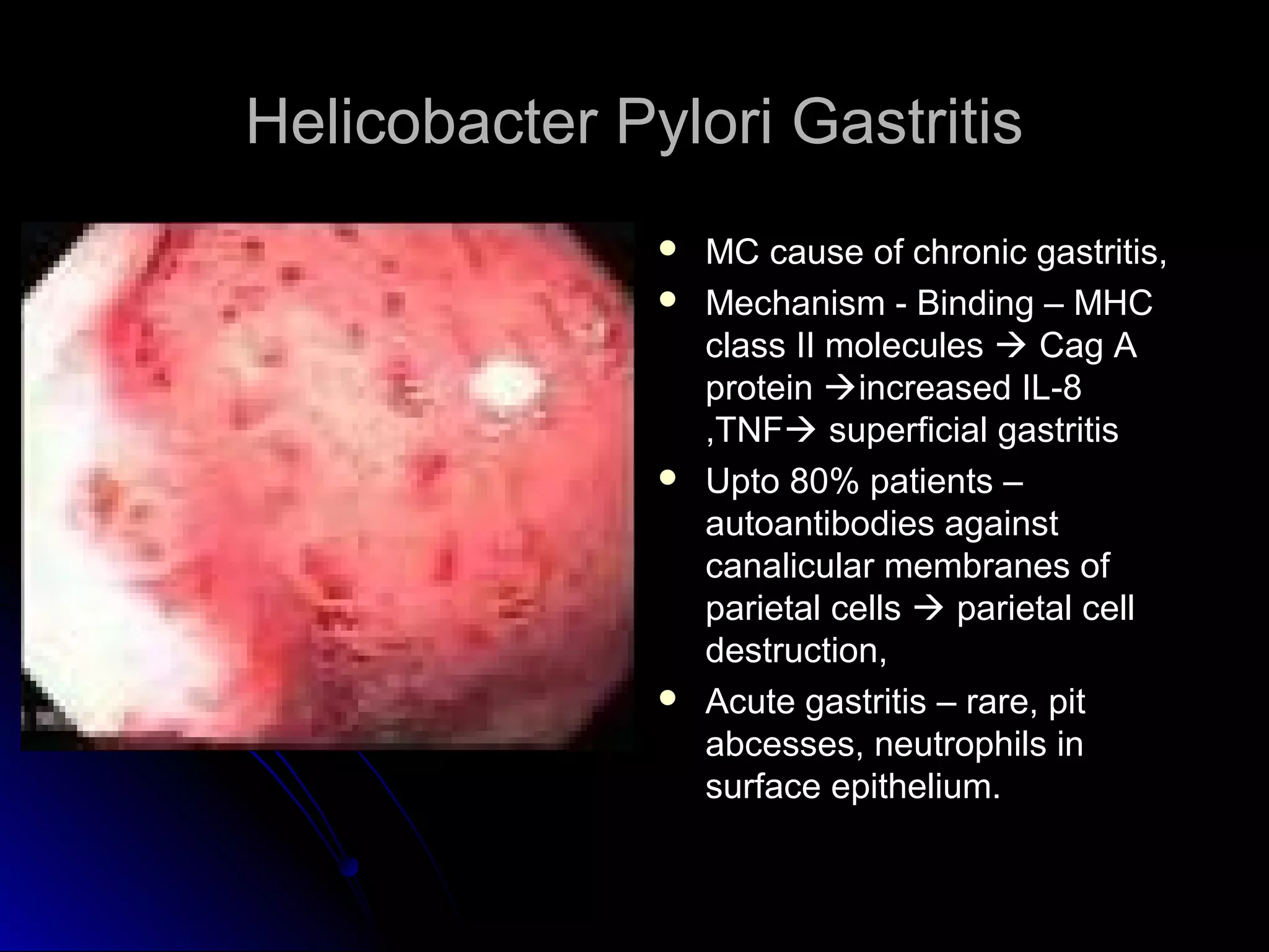 Helicobacter Pylori GastritisHelicobacter Pylori Gastritis
 MC cause of chronic gastritis,MC cause of chronic gastritis,
 Mechanism - Binding – MHCMechanism - Binding – MHC
class II moleculesclass II molecules  Cag ACag A
proteinprotein increased IL-8increased IL-8
,TNF,TNF superficial gastritissuperficial gastritis
 Upto 80% patients –Upto 80% patients –
autoantibodies againstautoantibodies against
canalicular membranes ofcanalicular membranes of
parietal cellsparietal cells  parietal cellparietal cell
destruction,destruction,
 Acute gastritis – rare, pitAcute gastritis – rare, pit
abcesses, neutrophils inabcesses, neutrophils in
surface epithelium.surface epithelium.
 