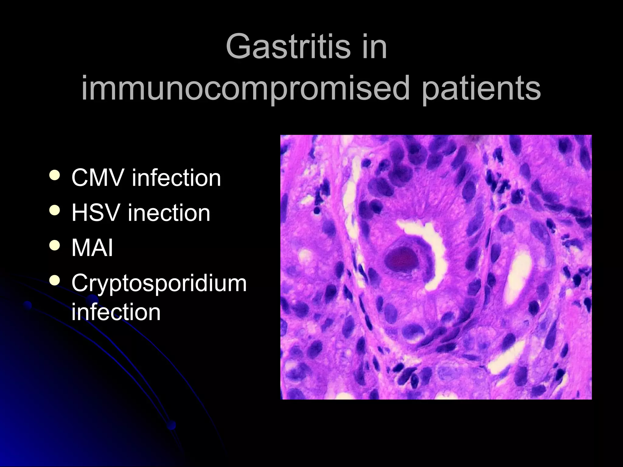 Gastritis inGastritis in
immunocompromised patientsimmunocompromised patients
 CMV infectionCMV infection
 HSV inectionHSV inection
 MAIMAI
 CryptosporidiumCryptosporidium
infectioninfection
 