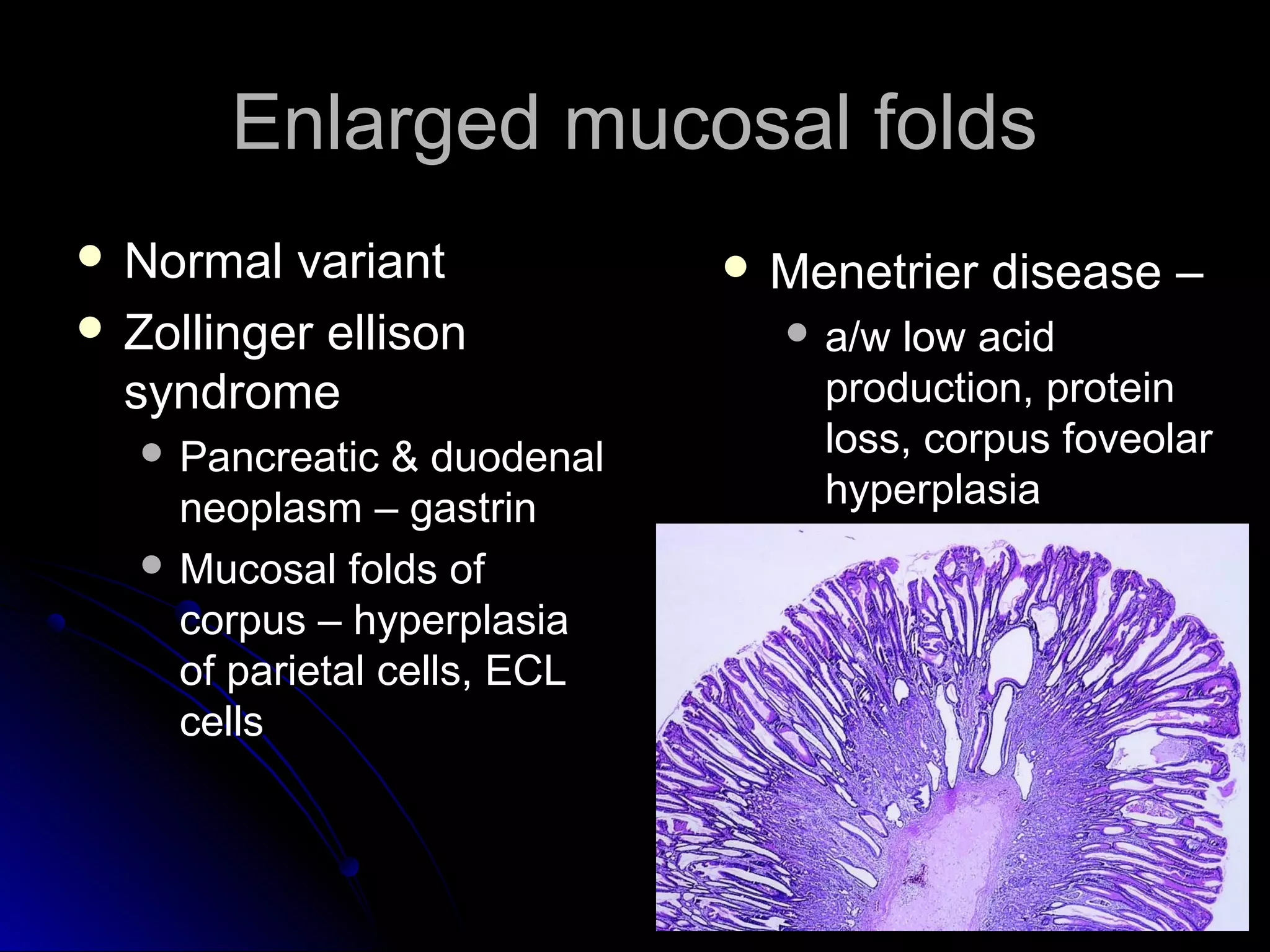 Enlarged mucosal foldsEnlarged mucosal folds
 Normal variantNormal variant
 Zollinger ellisonZollinger ellison
syndromesyndrome
 Pancreatic & duodenalPancreatic & duodenal
neoplasm – gastrinneoplasm – gastrin
 Mucosal folds ofMucosal folds of
corpus – hyperplasiacorpus – hyperplasia
of parietal cells, ECLof parietal cells, ECL
cellscells
 Menetrier disease –Menetrier disease –
 a/w low acida/w low acid
production, proteinproduction, protein
loss, corpus foveolarloss, corpus foveolar
hyperplasiahyperplasia
 