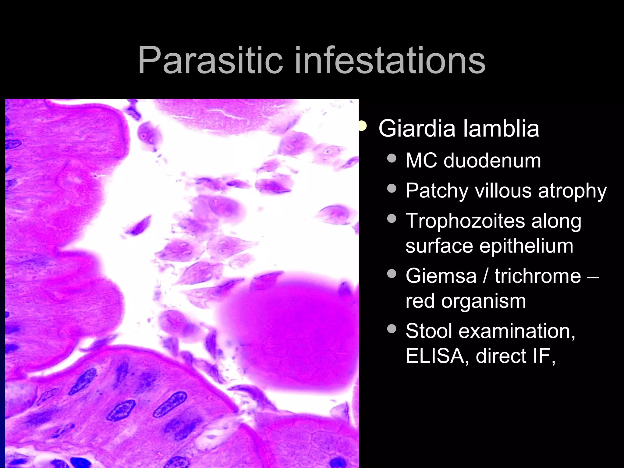 Parasitic infestationsParasitic infestations
 Giardia lambliaGiardia lamblia
 MC duodenumMC duodenum
 Patchy villous atrophyPatchy villous atrophy
 Trophozoites alongTrophozoites along
surface epitheliumsurface epithelium
 Giemsa / trichrome –Giemsa / trichrome –
red organismred organism
 Stool examination,Stool examination,
ELISA, direct IF,ELISA, direct IF,
 