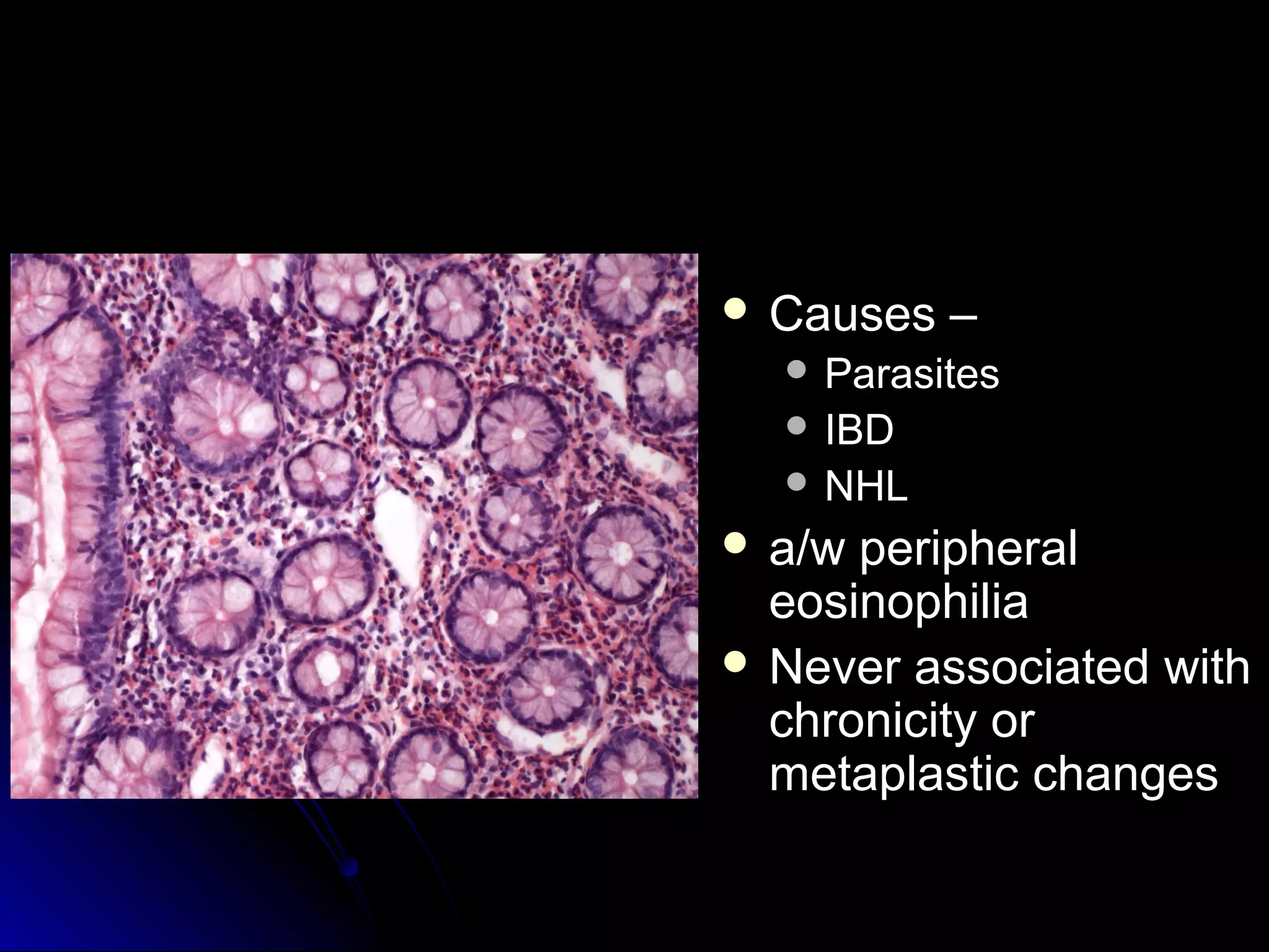  Causes –Causes –
 ParasitesParasites
 IBDIBD
 NHLNHL
 a/w peripherala/w peripheral
eosinophiliaeosinophilia
 Never associated withNever associated with
chronicity orchronicity or
metaplastic changesmetaplastic changes
 