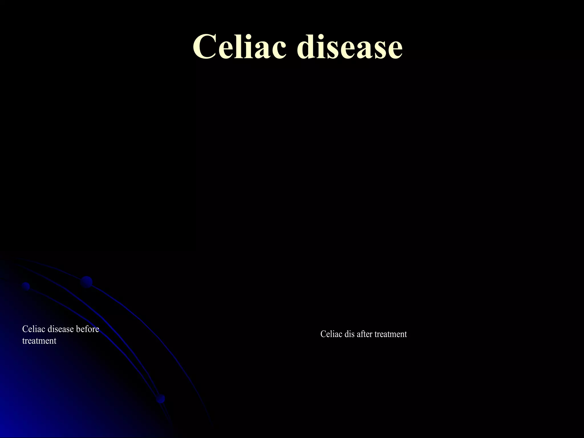 Celiac disease
Celiac disease before
treatment
Celiac dis after treatment
 