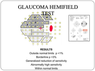 GLAUCOMA HEMIFIELD
TEST

RESULTS
Outside normal limits p <1%
Borderline p <3%
Generalized reduction of sensitivity
Abnormally high sensitivity
Within normal limits

 