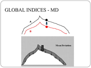 GLOBAL INDICES - MD
A

B

 