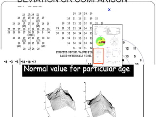 DEVIATION OR COMPARISON
PLOTS
& PROBABILITY

 