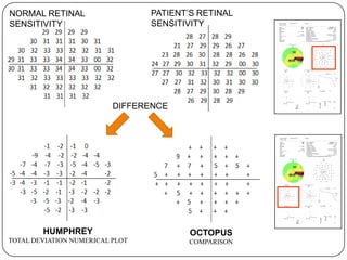 PATIENT’S RETINAL
SENSITIVITY

NORMAL RETINAL
SENSITIVITY

DIFFERENCE

HUMPHREY

OCTOPUS

TOTAL DEVIATION NUMERICAL PLOT

COMPARISON

 