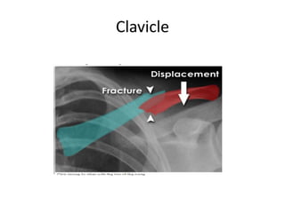 Interpretation of musculoskeletal x rays | PPTX