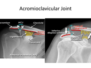 Normal Acj Interval Interpretation of musculoskeletal x rays | PPTX
