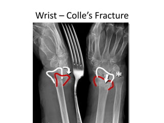 Interpretation of musculoskeletal x rays | PPTX