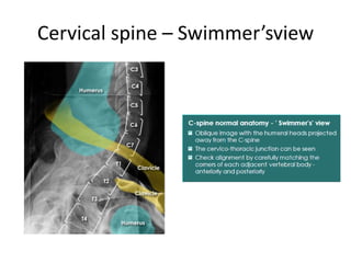 Twining Method Radiography Interpretation of musculoskeletal x rays | PPTX
