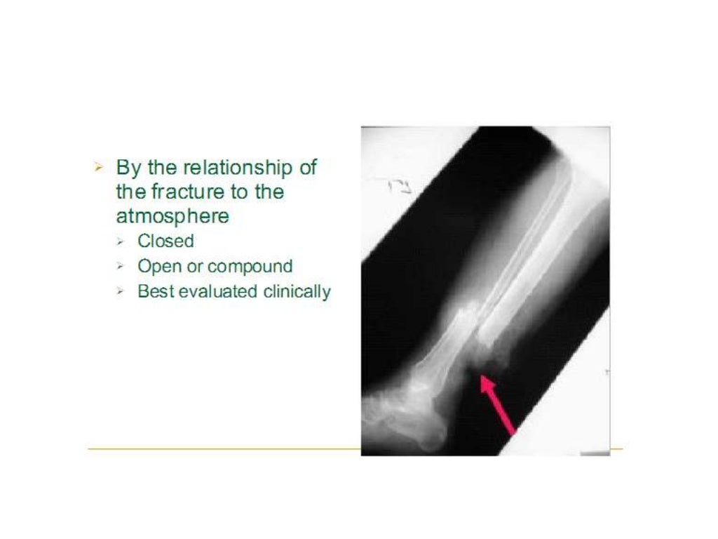 Interpretation of musculoskeletal x rays