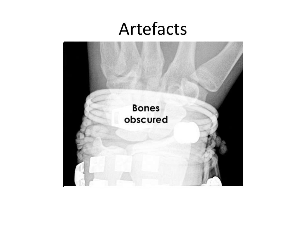 Interpretation of musculoskeletal x rays