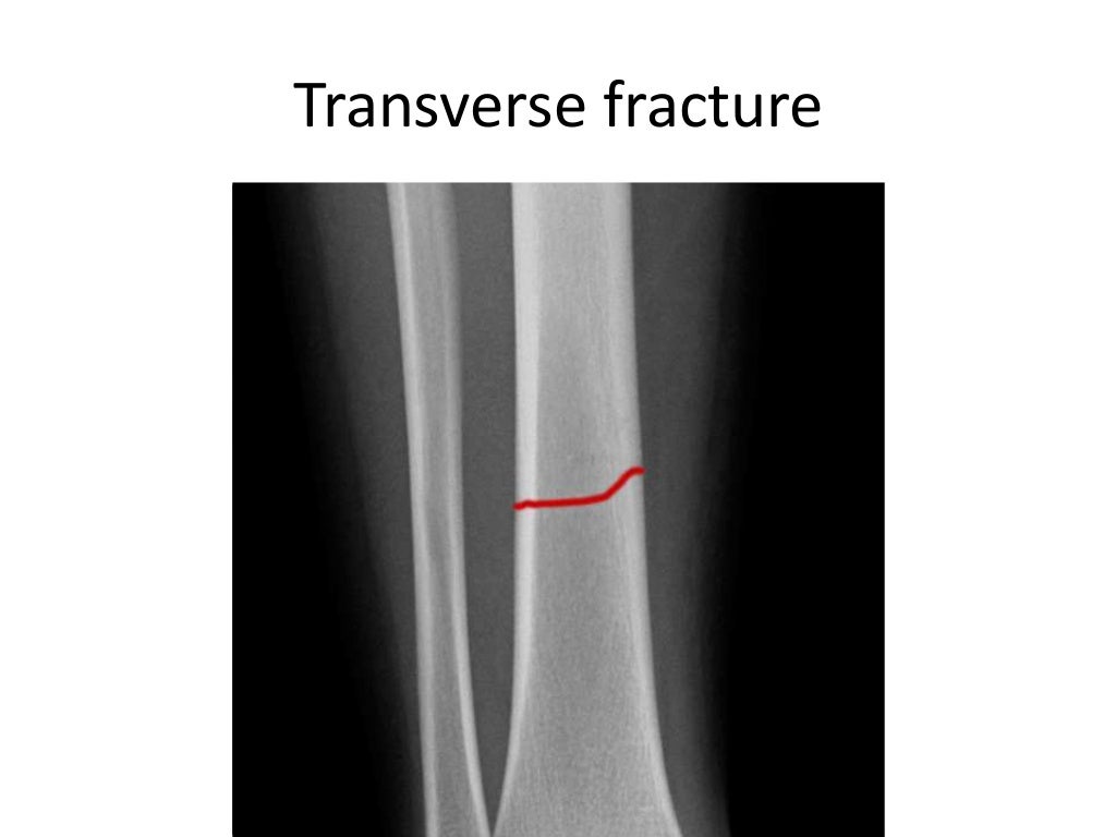 Interpretation of musculoskeletal x rays