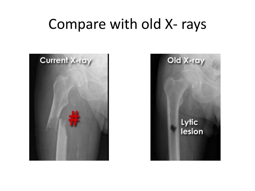 Interpretation of musculoskeletal x rays