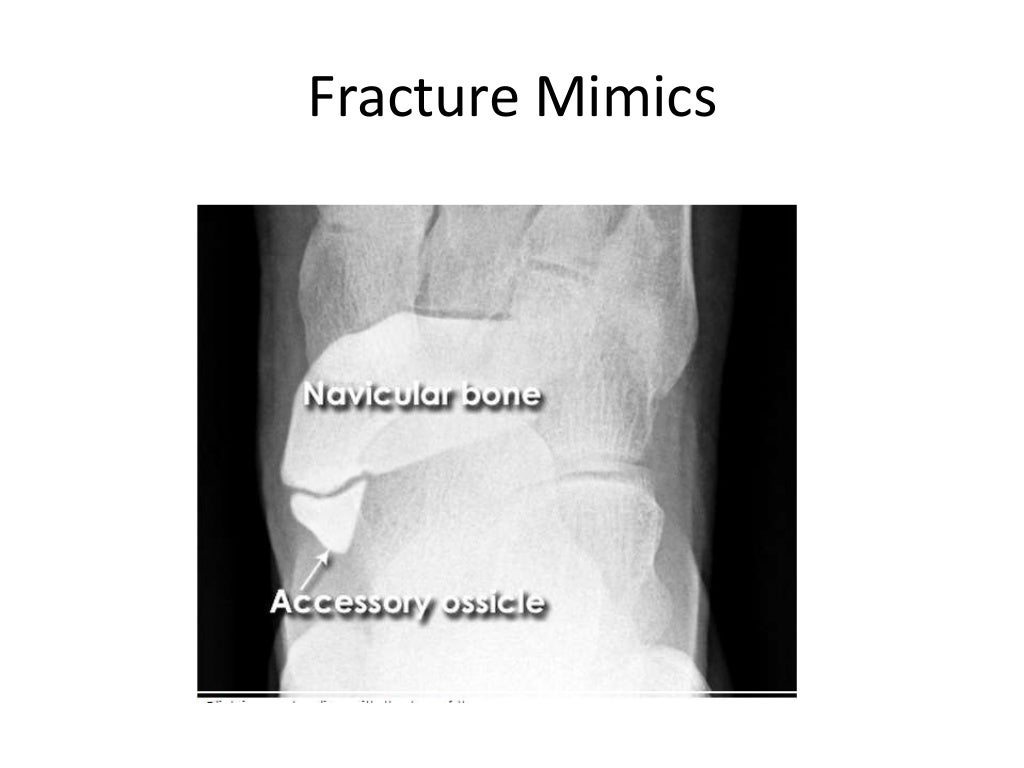 Interpretation of musculoskeletal x rays