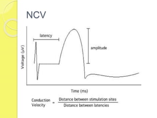 NCV
 