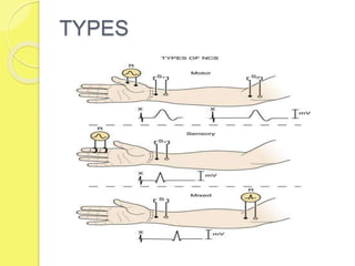 TYPES
 