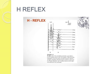 H REFLEX
 