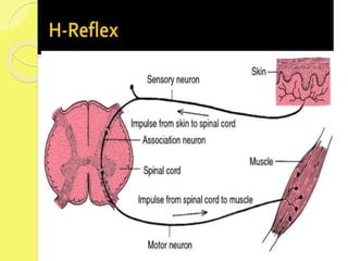 H - REFLEX
 