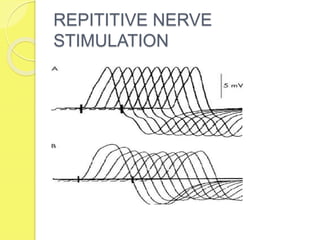 REPITITIVE NERVE
STIMULATION
 