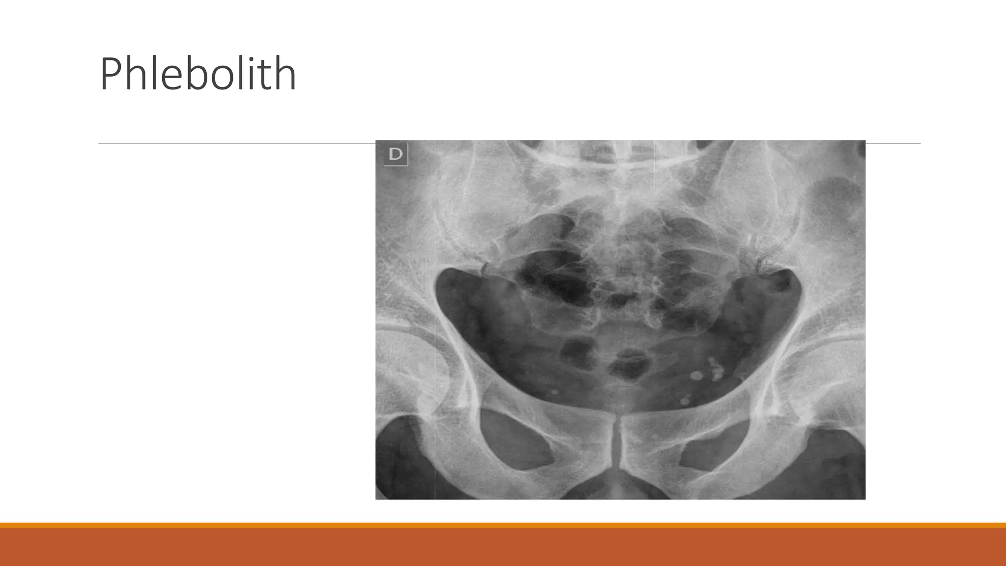 Interpretation of normal radiograph | PPTX | Death, Injury, or Military ...