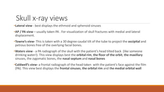 Roberts View Radiographs Interpretation of normal radiograph | PPTX