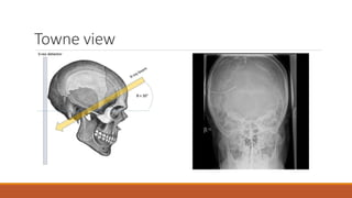 Interpretation of normal radiograph | PPTX