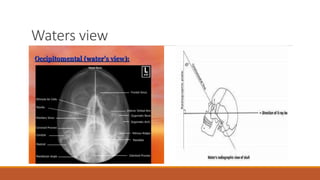 Interpretation of normal radiograph | PPTX