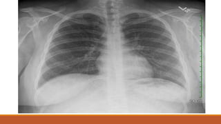 Interpretation of normal radiograph | PPTX