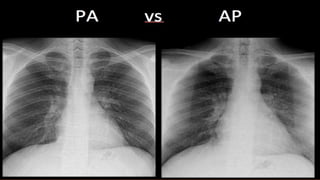 Interpretation of normal radiograph | PPTX