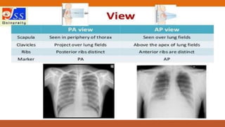 Interpretation of normal radiograph | PPTX