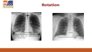 Interpretation of normal radiograph | PPTX