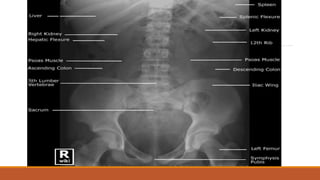Interpretation of normal radiograph | PPTX