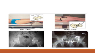 Interpretation of normal radiograph | PPTX