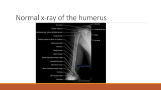 Interpretation of normal radiograph | PPTX