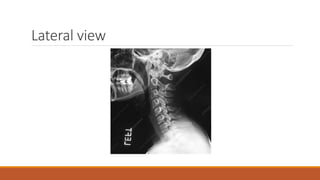 Interpretation of normal radiograph | PPTX