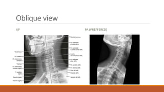 Interpretation of normal radiograph | PPTX