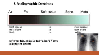 Interpretation of normal radiograph | PPTX