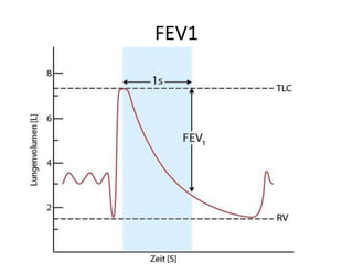 FEV1
 