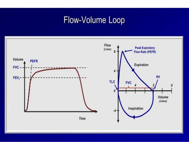 Interpretation of Pulmonary Function Test