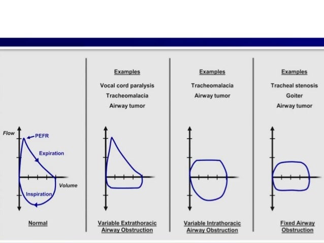 Interpretation of Pulmonary Function Test
