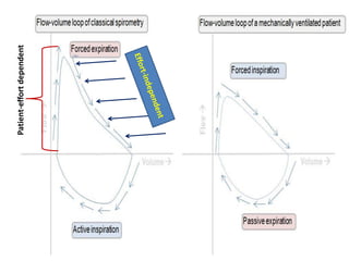 Patient-effort
dependent
 