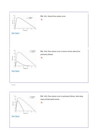 View Figure
FIG. 14-1. Normal flow-volume curve.
View Figure
FIG. 14-2. Flow-volume curve in severe chronic obstructive
pulmonary disease.
P.131
View Figure
FIG. 14-3. Flow-volume curve in pulmonary fibrosis. Note steep
slope and decreased volume.
 