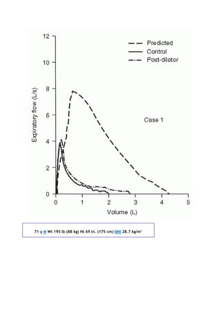 71 y M Wt 195 lb (88 kg) Ht 69 in. (175 cm) BMI 28.7 kg/m2
 
