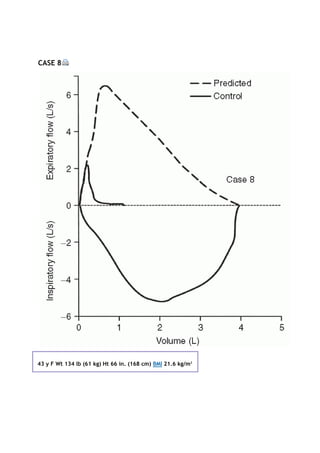 CASE 8
43 y F Wt 134 lb (61 kg) Ht 66 in. (168 cm) BMI 21.6 kg/m2
 