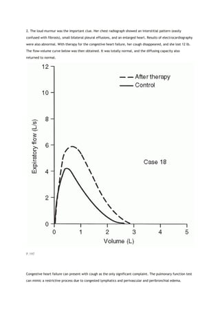 2. The loud murmur was the important clue. Her chest radiograph showed an interstitial pattern (easily
confused with fibrosis), small bilateral pleural effusions, and an enlarged heart. Results of electrocardiography
were also abnormal. With therapy for the congestive heart failure, her cough disappeared, and she lost 12 lb.
The flow-volume curve below was then obtained. It was totally normal, and the diffusing capacity also
returned to normal.
P.197
Congestive heart failure can present with cough as the only significant complaint. The pulmonary function test
can mimic a restrictive process due to congested lymphatics and perivascular and peribronchial edema.
 