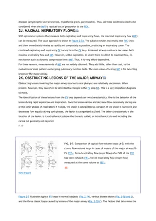 diseases (amyotrophic lateral sclerosis, myasthenia gravis, polymyositis). Thus, all these conditions need to be
considered when the MVV is reduced out of proportion to the FEV1.
2J. MAXIMAL INSPIRATORY FLOWS
With spirometer systems that measure both expiratory and inspiratory flows, the maximal inspiratory flow (MIF)
can be measured. The usual approach is shown in Figure 2-7A. The subject exhales maximally (the FVC test)
and then immediately inhales as rapidly and completely as possible, producing an inspiratory curve. The
combined expiratory and inspiratory FV curves form the FV loop. Increased airway resistance decreases both
maximal expiratory flow and MIF. However, unlike expiration, in which there is a limit to maximal flow, no
mechanism such as dynamic compression limits MIF. Thus, it is very effort-dependent.
For these reasons, measurements of MIF are not widely obtained. They add little, other than cost, to the
evaluation of most patients undergoing pulmonary function tests. The main value of testing MIF is for detecting
lesions of the major airway.
2K. OBSTRUCTING LESIONS OF THE MAJOR AIRWAY
Obstructing lesions involving the major airway (carina to oral pharynx) are relatively uncommon. When
present, however, they can often be detected by changes in the FV loop [2]. This is a very important diagnosis
to make.
The identification of these lesions from the FV loop depends on two characteristics. One is the behavior of the
lesion during rapid expiration and inspiration. Does the lesion narrow and decrease flow excessively during one
or the other phases of respiration? If it does, the lesion is categorized as variable. If the lesion is narrowed and
decreases flow equally during both phases, the lesion is categorized as fixed. The other characteristic is the
location of the lesion. Is it extrathoracic (above the thoracic outlet) or intrathoracic (to and including the
carina but generally not beyond)?
P.19
View Figure
FIG. 2-7. Comparison of typical flow-volume loops (A-C) with the
classic flow-volume loops in cases of lesions of the major airway (D-
F). FEF50, forced expiratory flow (expir flow) after 50% of the FVC
has been exhaled; FIF50, forced inspiratory flow (inspir flow)
measured at the same volume as FEF50.
Figure 2-7 illustrates typical FV loops in normal subjects (Fig. 2-7A), various disease states (Fig. 2-7B and C),
and the three classic loops caused by lesions of the major airway (Fig. 2-7D-F). The factors that determine the
 