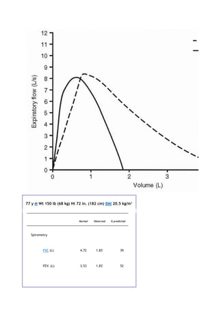77 y M Wt 150 lb (68 kg) Ht 72 in. (182 cm) BMI 20.5 kg/m2
Normal Observed % predicted
Spirometry
FVC (L) 4.72 1.83*
39
FEV1 (L) 3.53 1.83*
52
 