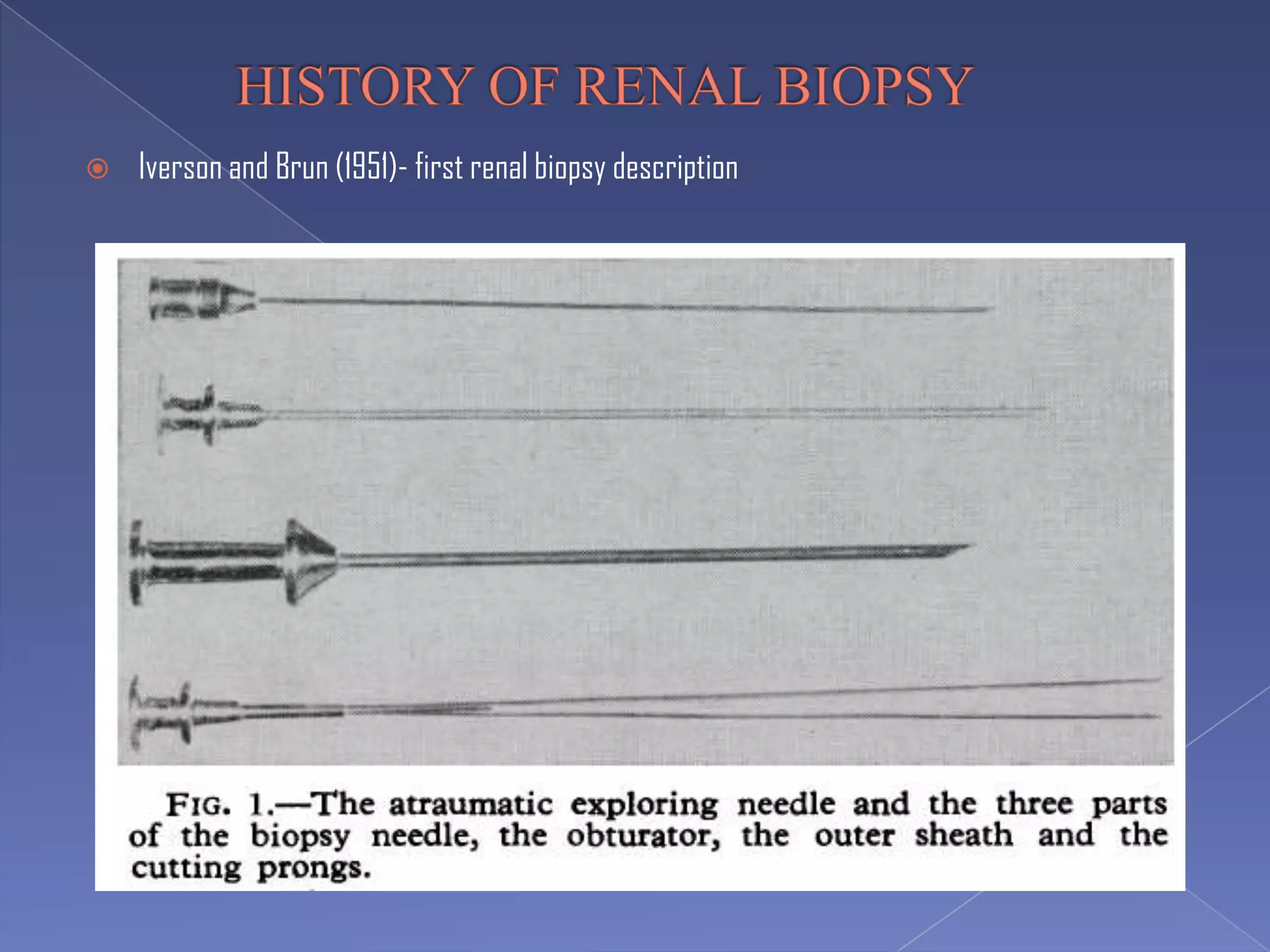  Iverson and Brun (1951)- first renal biopsy description
 