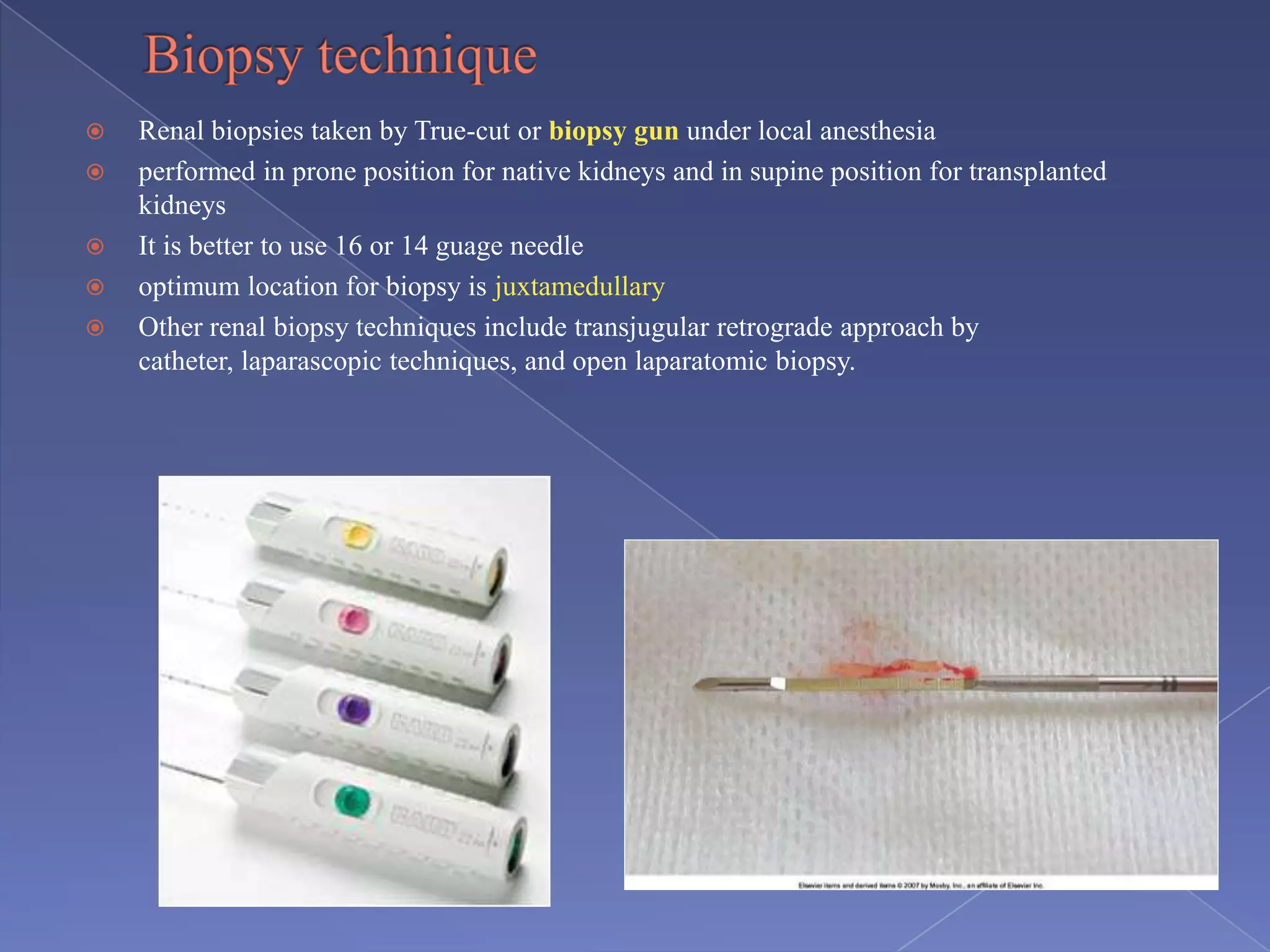  Renal biopsies taken by True-cut or biopsy gun under local anesthesia
 performed in prone position for native kidneys and in supine position for transplanted
kidneys
 It is better to use 16 or 14 guage needle
 optimum location for biopsy is juxtamedullary
 Other renal biopsy techniques include transjugular retrograde approach by
catheter, laparascopic techniques, and open laparatomic biopsy.
 